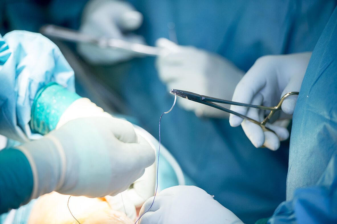 Operation Operation